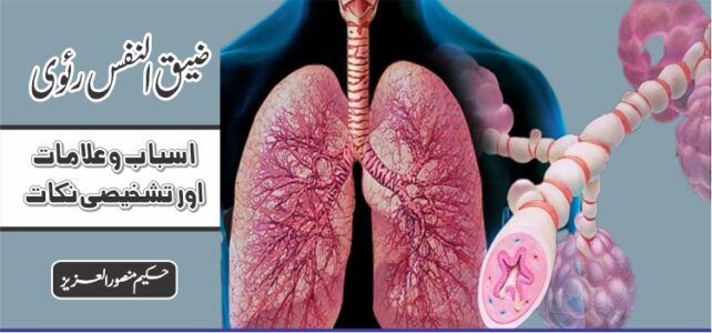 ضیق النفس رئوی