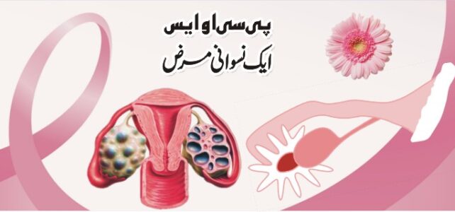 پی سی او ایس… ایک نسوانی مرض